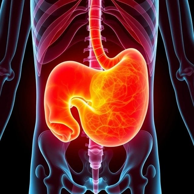 Gallbladder Cancer Ka Ilaj