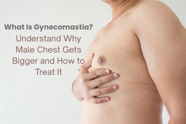 What Is Gynecomastia