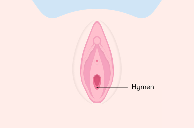 Hymen Repair Without Surgery