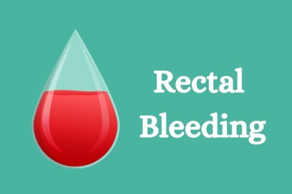 anal bleeding