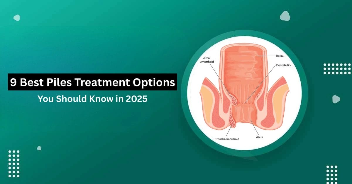 best piles treatment option